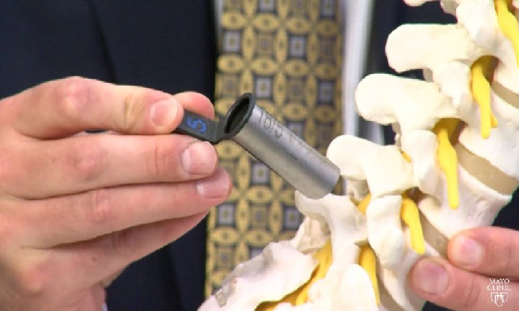 minimally invasive spine surgery minimally invasive spine surgery