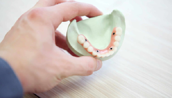 Dentures and Gag Reflex