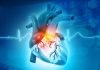 Cardiology